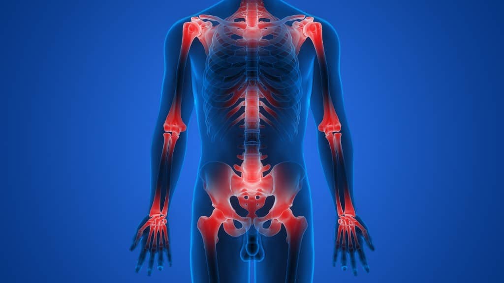 Arthrose : dossier complet