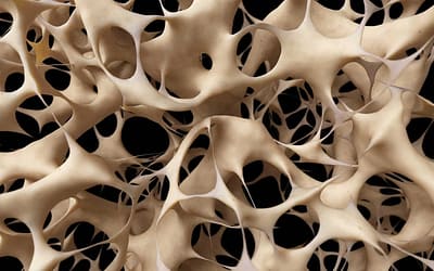 Ostéoporose : le dossier complet