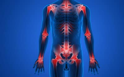 Arthrose : dossier complet
